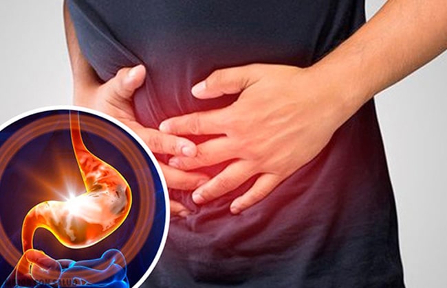 Xroniki qastrit foto 4